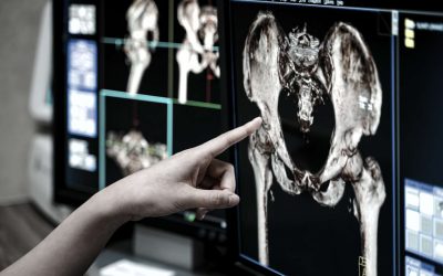 Arthrographie
